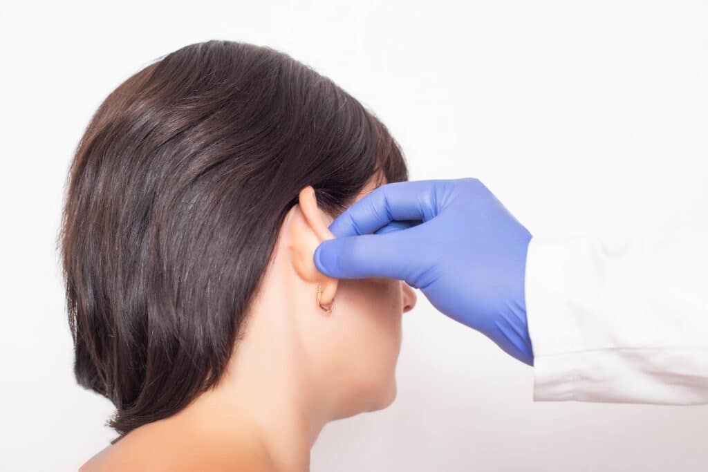 What is otoplasty?